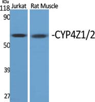 CYP4Z1/2 Polyclonal Antibody