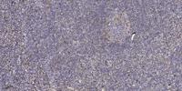CYP4Z1/2 Polyclonal Antibody