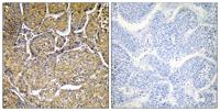 CYP8B1 Polyclonal Antibody