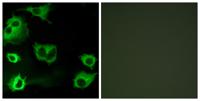 CysLTR1 Polyclonal Antibody