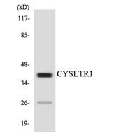 CysLTR1 Polyclonal Antibody