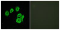CysLTR1 Polyclonal Antibody