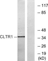 CysLTR1 Polyclonal Antibody