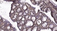 CysLTR1 Polyclonal Antibody