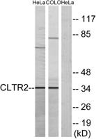 CysLTR2 Polyclonal Antibody