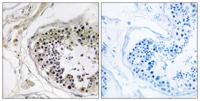 Cystatin 8 Polyclonal Antibody