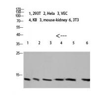 Cystatin A Polyclonal Antibody