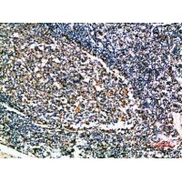 Cystatin A Polyclonal Antibody