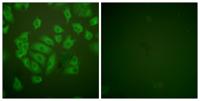 Cystatin A Polyclonal Antibody