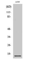 Cystatin B Polyclonal Antibody