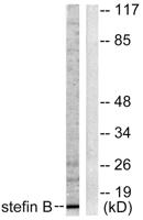 Cystatin B Polyclonal Antibody
