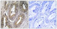 Cystatin SA Polyclonal Antibody
