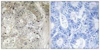 Cystatin SN Polyclonal Antibody