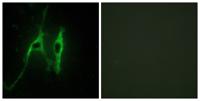 Cytochrome b5 Polyclonal Antibody