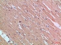 Cytoglobin Polyclonal Antibody