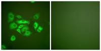Cytokeratin 10 Polyclonal Antibody