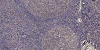 Cytokeratin 10 Polyclonal Antibody