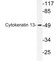 Cytokeratin 13 Polyclonal Antibody
