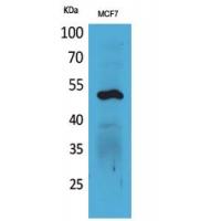Cytokeratin 14 Polyclonal Antibody