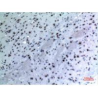 Cytokeratin 14 Polyclonal Antibody