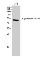 Cytokeratin 14/16 Polyclonal Antibody