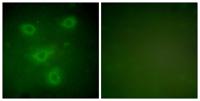 Cytokeratin 14/16 Polyclonal Antibody