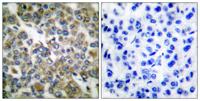 Cytokeratin 14/16 Polyclonal Antibody