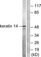 Cytokeratin 14/16 Polyclonal Antibody