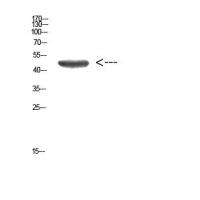Cytokeratin 14/17 Polyclonal Antibody