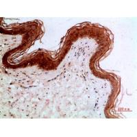 Cytokeratin 14/17 Polyclonal Antibody