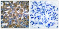Cytokeratin 15 Polyclonal Antibody