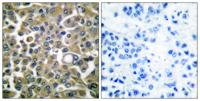 Cytokeratin 16 Polyclonal Antibody