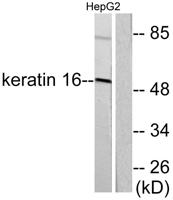 Cytokeratin 16 Polyclonal Antibody