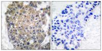 Cytokeratin 17 Polyclonal Antibody