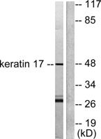 Cytokeratin 17 Polyclonal Antibody
