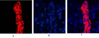 Cytokeratin 19 Polyclonal Antibody