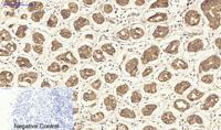 Cytokeratin 19 Polyclonal Antibody