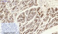 Cytokeratin 19 Polyclonal Antibody