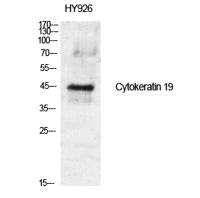 Cytokeratin 19 Polyclonal Antibody