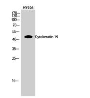 Cytokeratin 19 Polyclonal Antibody