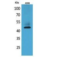 Cytokeratin 19 Polyclonal Antibody