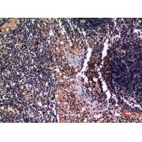 Cytokeratin 19 Polyclonal Antibody
