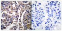 Cytokeratin 20 Polyclonal Antibody