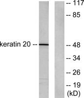 Cytokeratin 20 Polyclonal Antibody