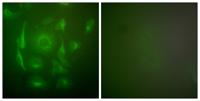 Cytokeratin 7 Polyclonal Antibody
