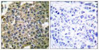 Cytokeratin 7 Polyclonal Antibody