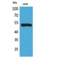 Cytokeratin 8 Polyclonal Antibody