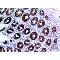 Cytokeratin 8 Polyclonal Antibody