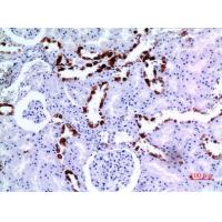 Cytokeratin 8 Polyclonal Antibody