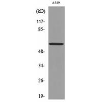 Cytokeratin 8 Polyclonal Antibody